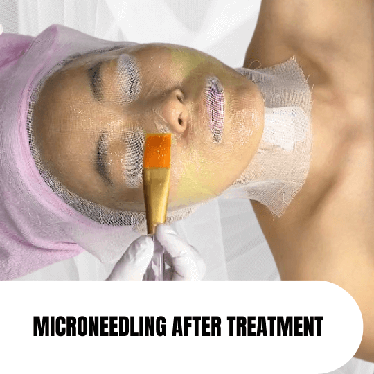 Microneedling Neck