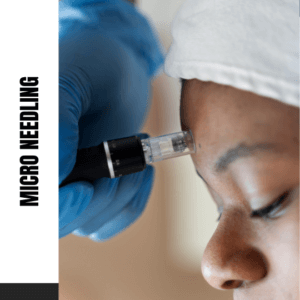 How Deep Does Microneedling Go?