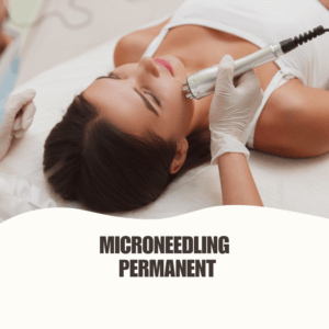 Is Microneedling Permanent