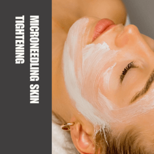 does-microneedling-help-with-hyperpigmentation