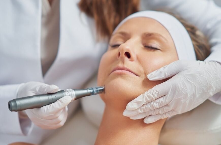 How Long After Microneedling Can I Workout?