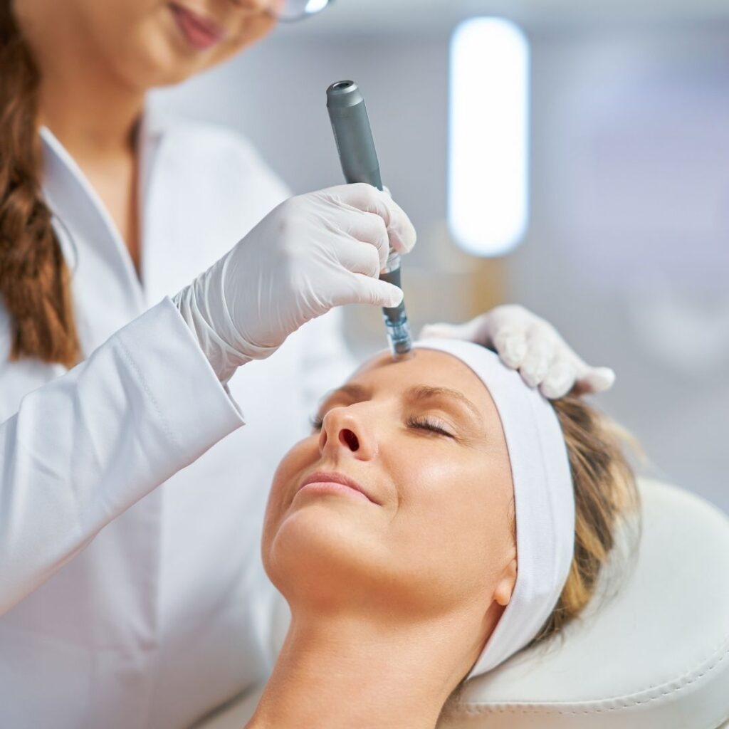 What To Expect With Microneedling