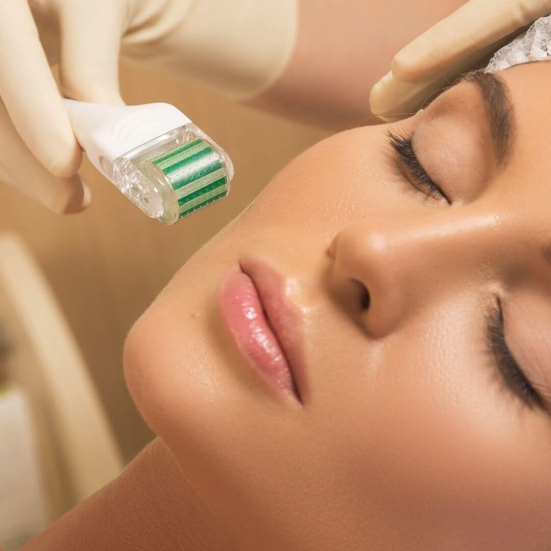 How Painful Is Microneedling?