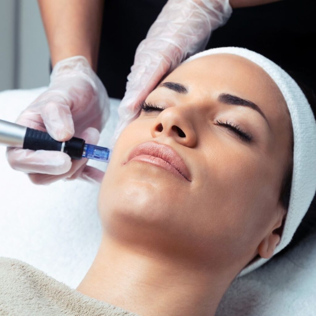 How Long Does It Take To Heal From Microneedling?