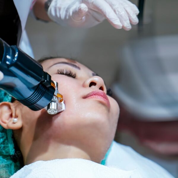 Best Microneedling