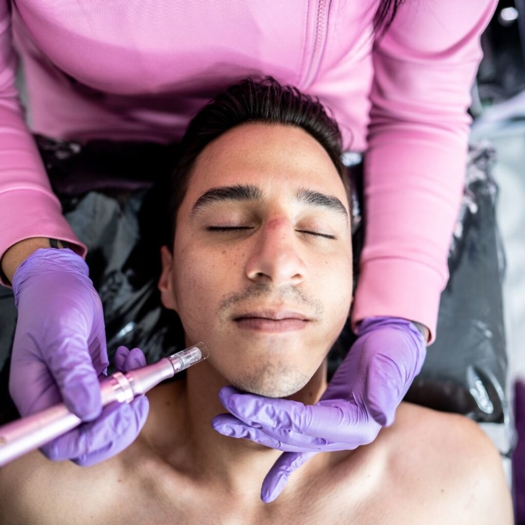 Microneedling with Botox