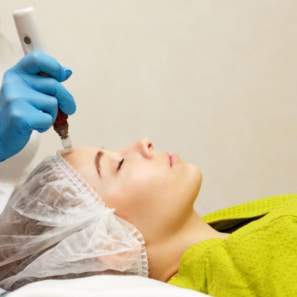 How Painful Is Microneedling?