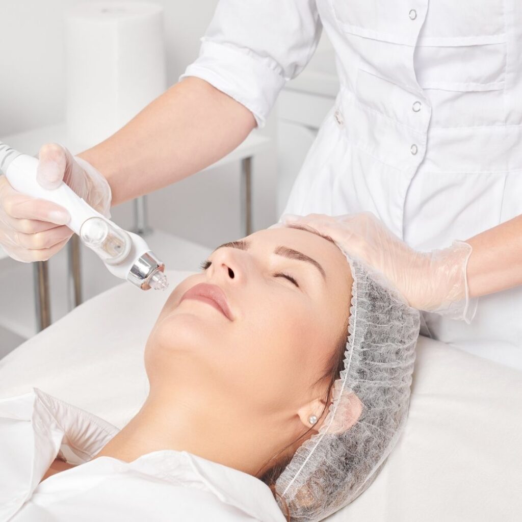 Microneedling