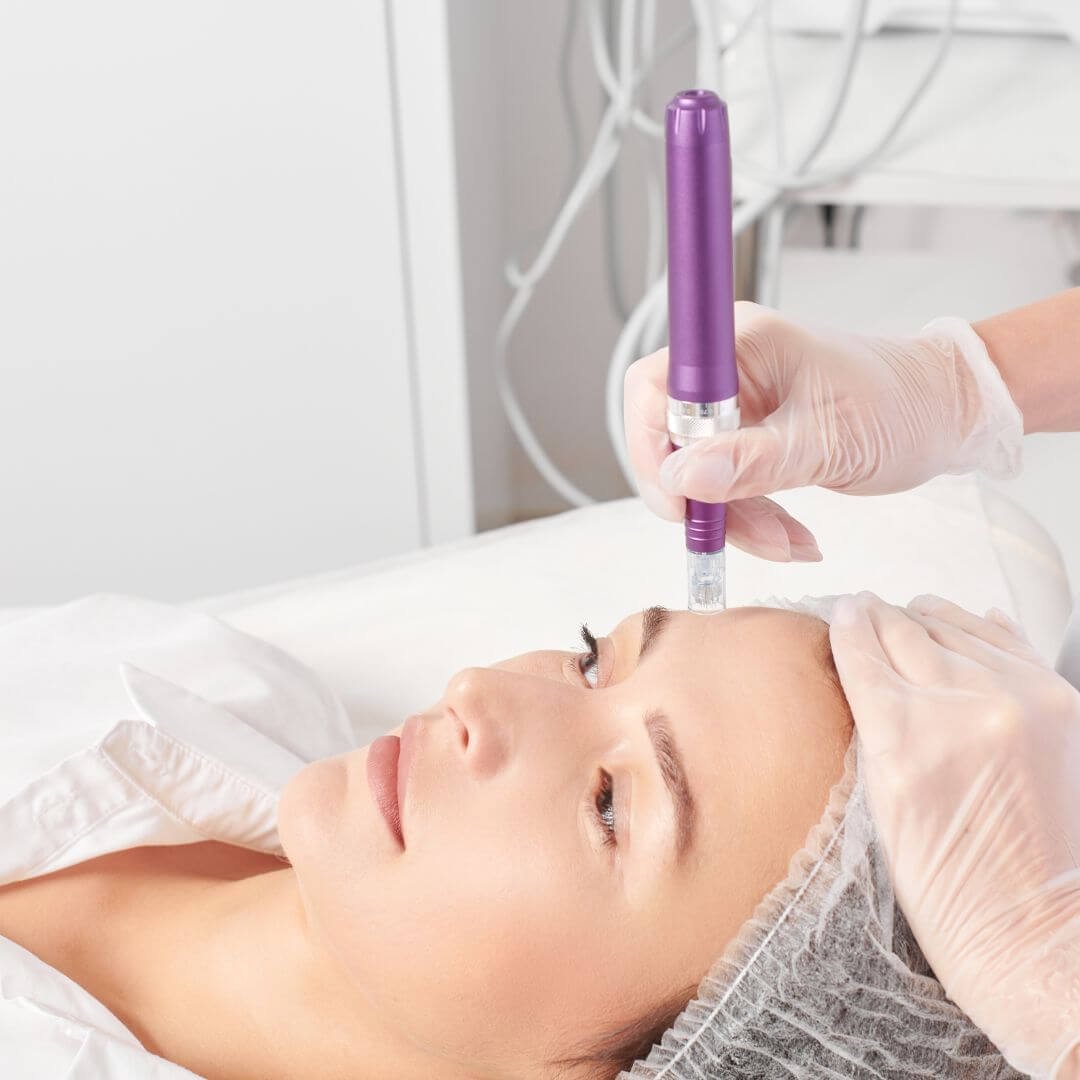 How Long Does Microneedling Results Last? https