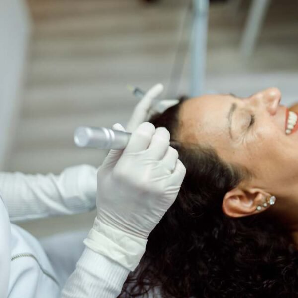 Microneedling Hair Growth