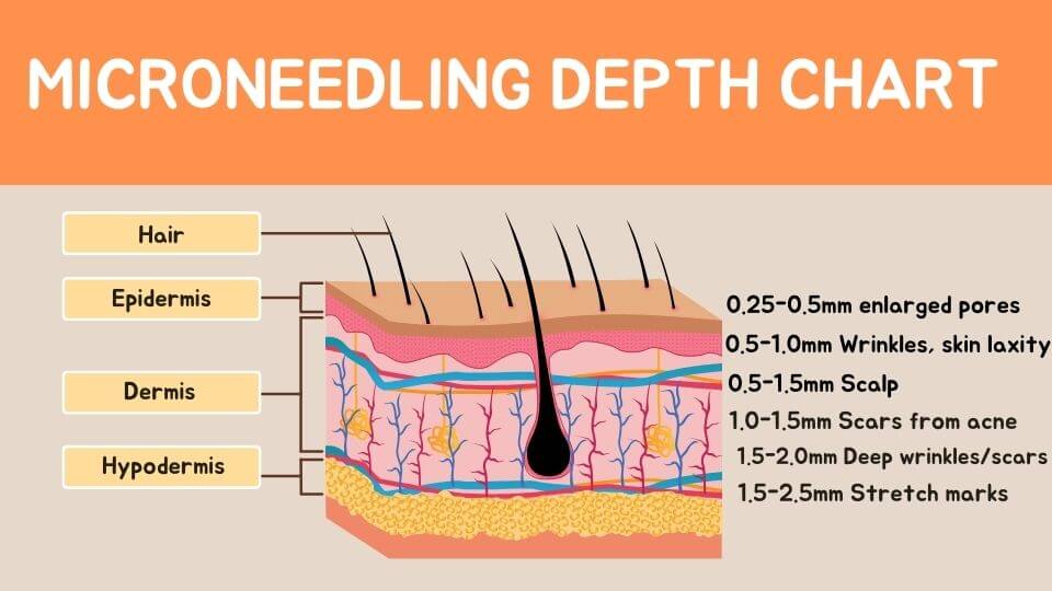 Microneedling Depth Chart