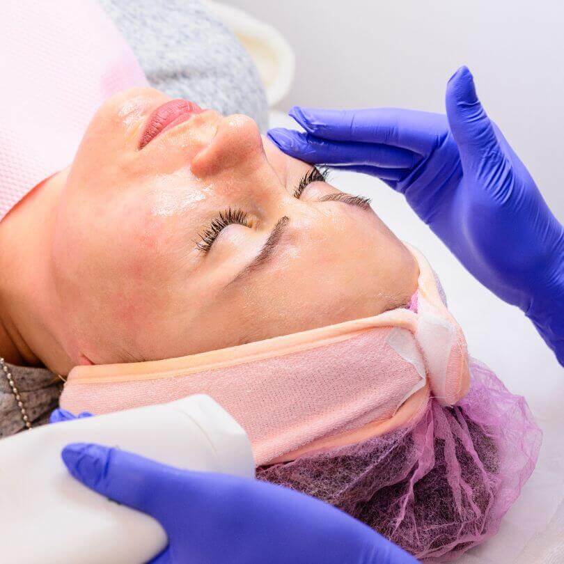 Microneedling Healing Stages