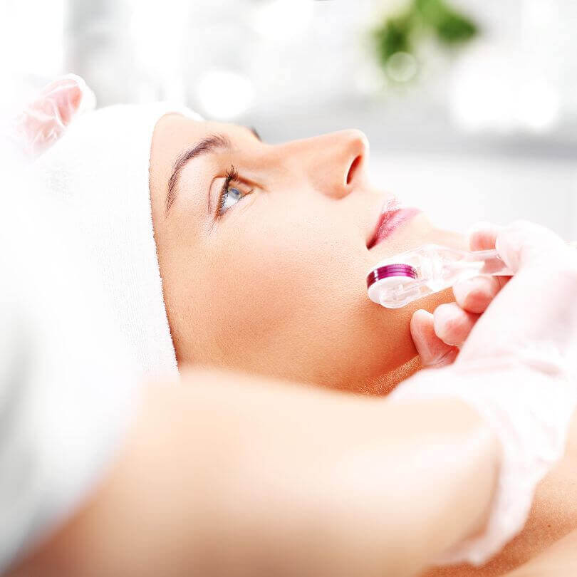 How Many Microneedling Sessions For Acne Scars?