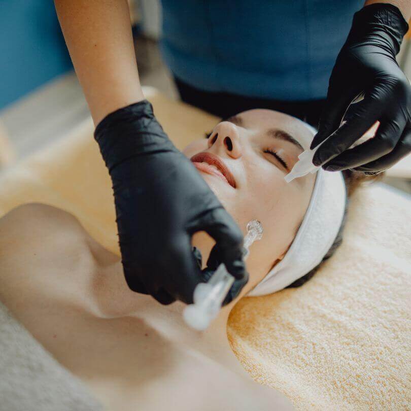 Microneedling Pigmentation