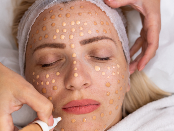 BB Glow Microneedling