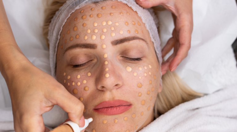 BB Glow Microneedling