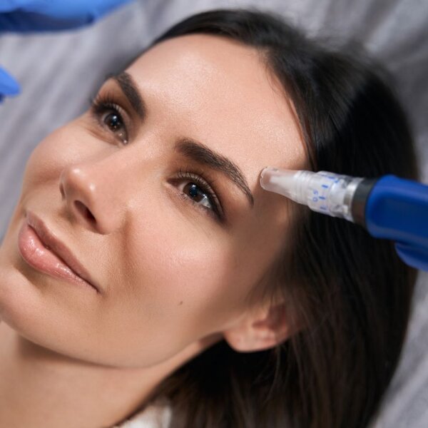 What qualification do I need to microneedle?