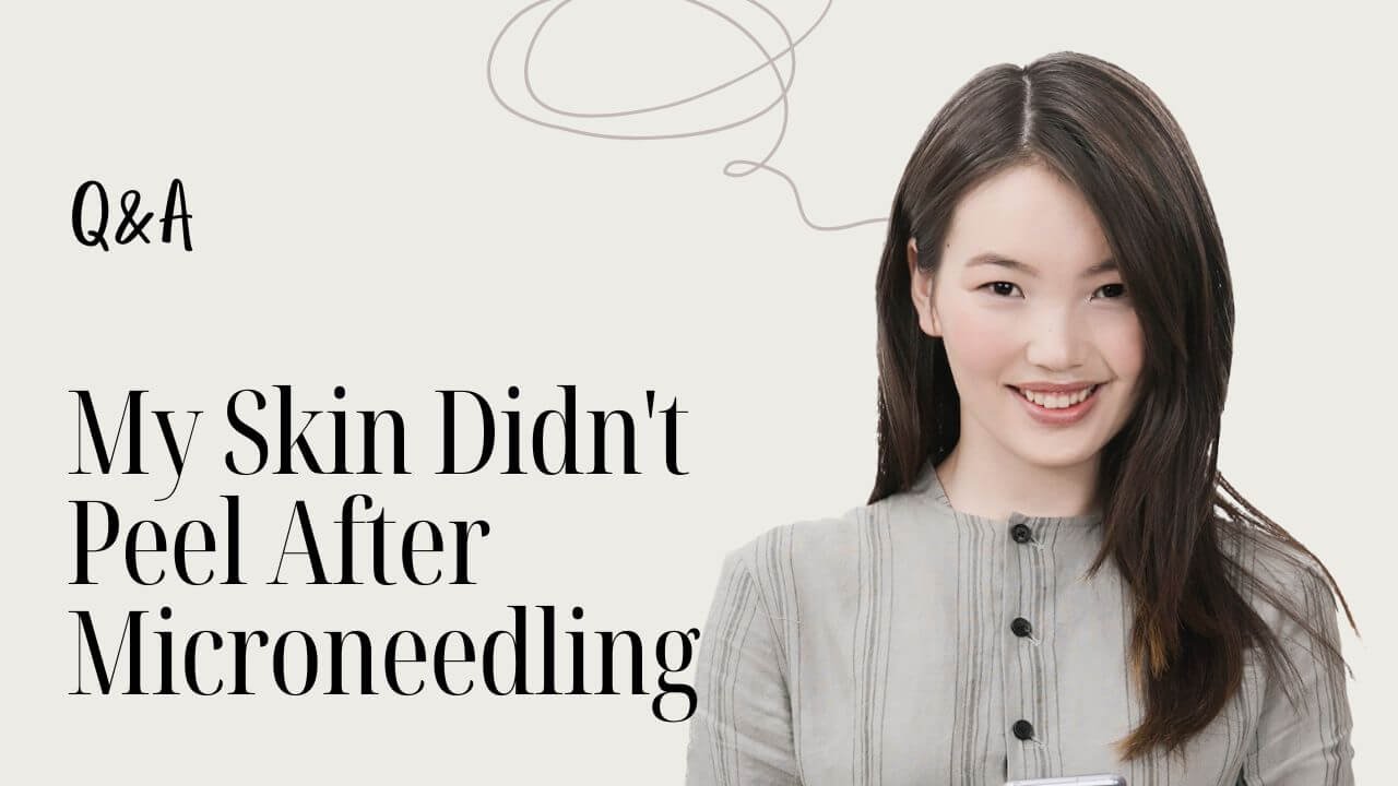 My Skin Didn't Peel After Microneedling