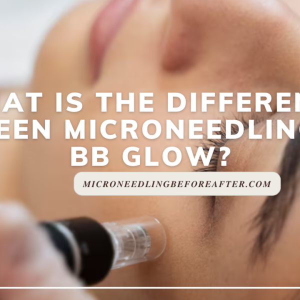 What Is The Difference Between Microneedling And BB Glow?