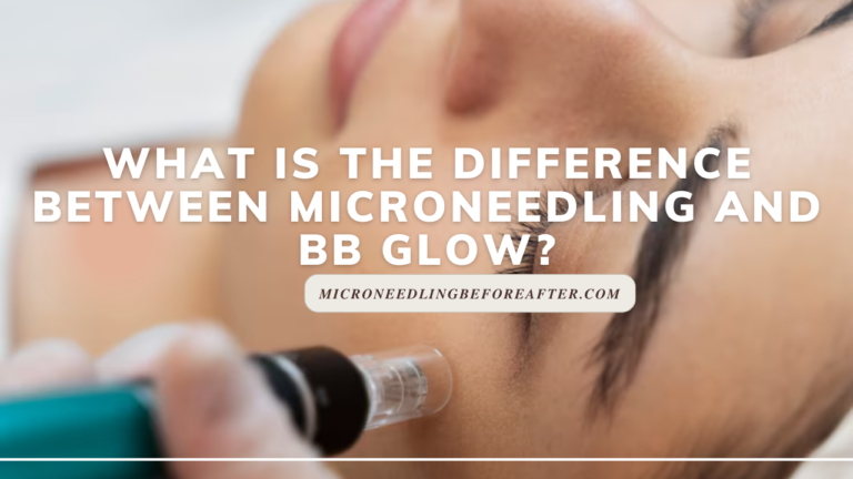 What Is The Difference Between Microneedling And BB Glow?