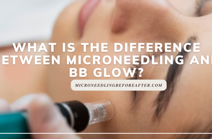 What Is The Difference Between Microneedling And BB Glow?