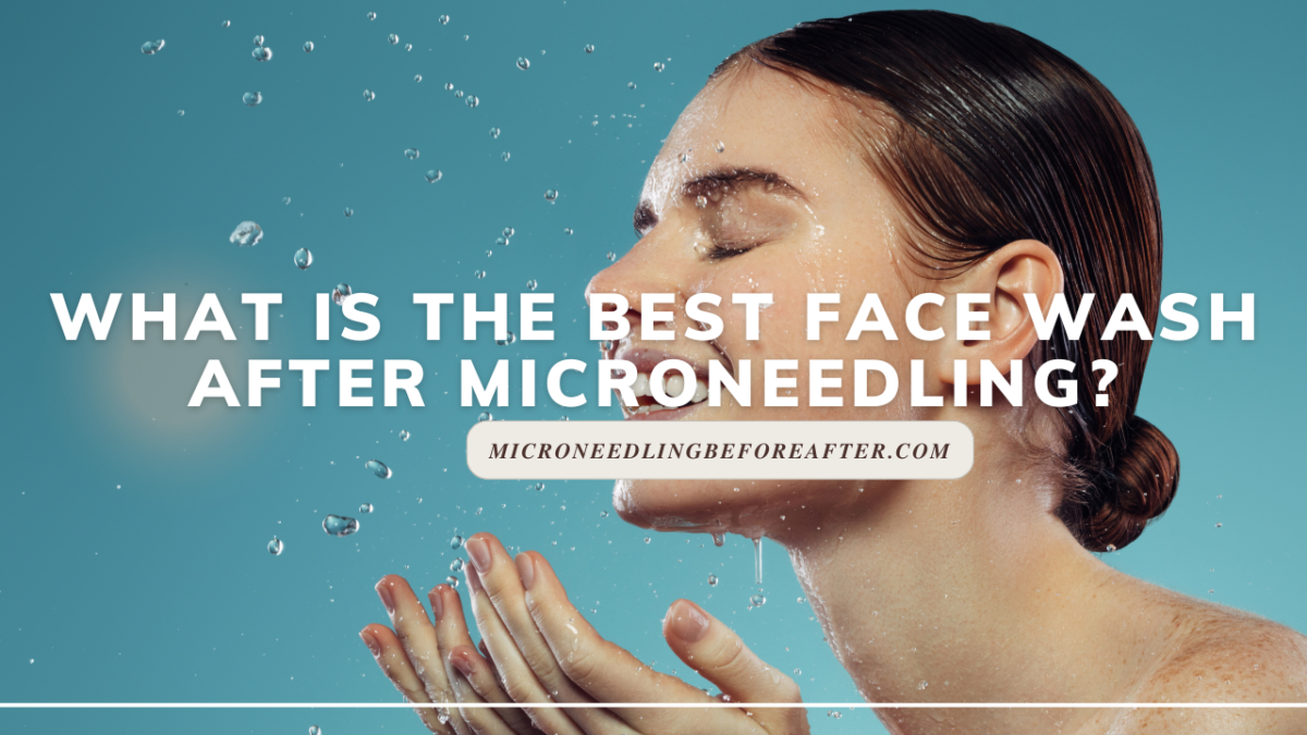 What Is The Best Face Wash After Microneedling?