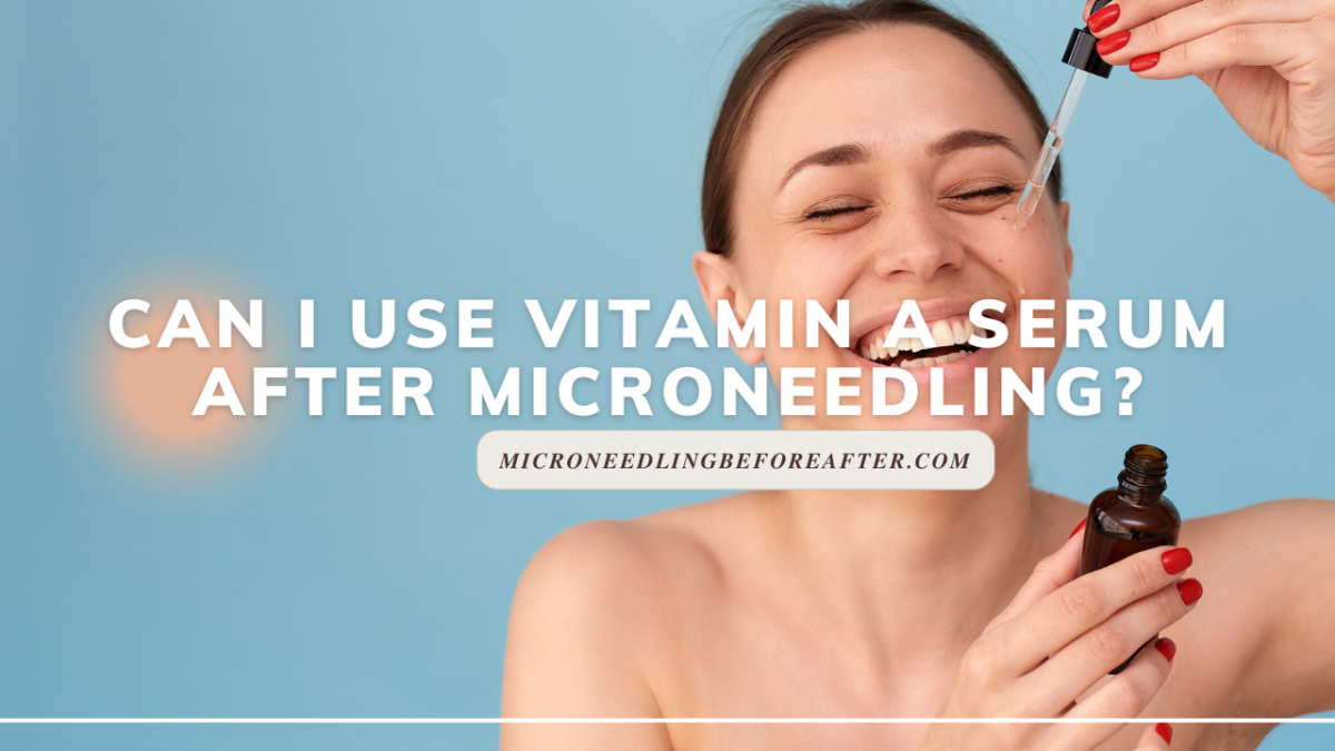 Can I Use Vitamin A Serum After Microneedling?