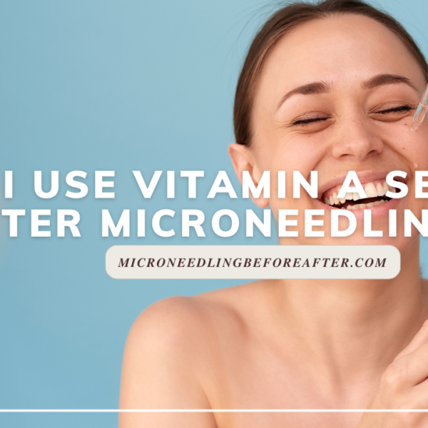 Can I Use Vitamin A Serum After Microneedling?