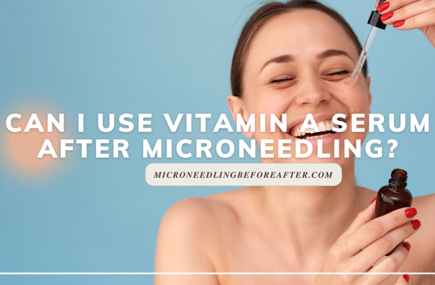 Can I Use Vitamin A Serum After Microneedling?