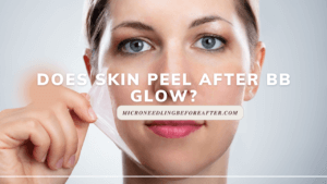 Does skin peel after BB Glow?