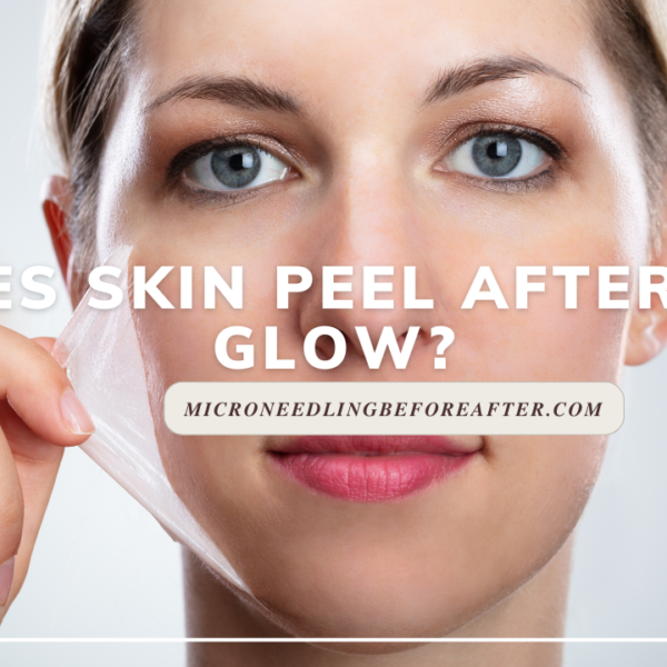 Does skin peel after BB Glow?