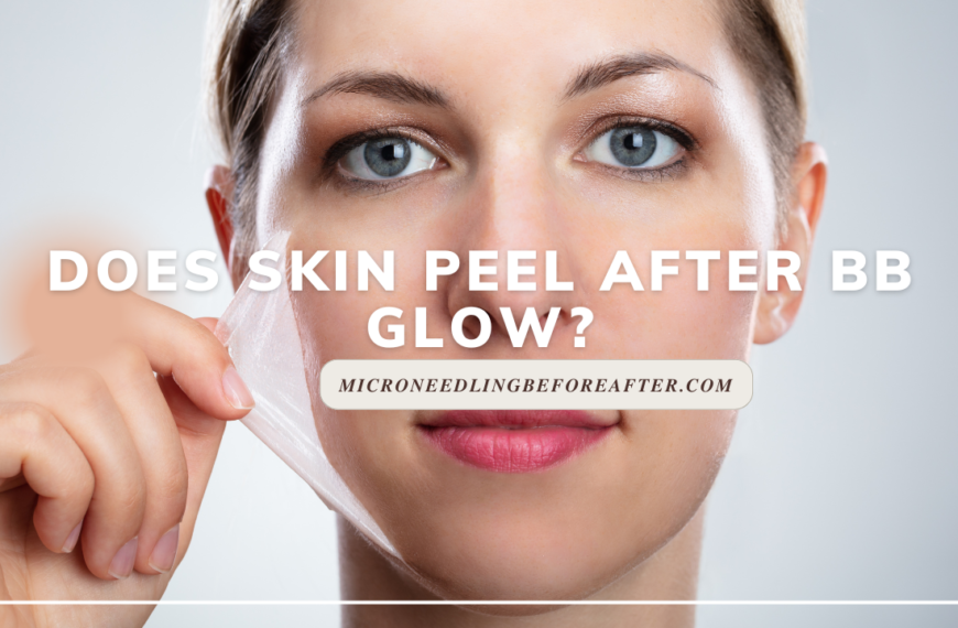 Does skin peel after BB Glow?