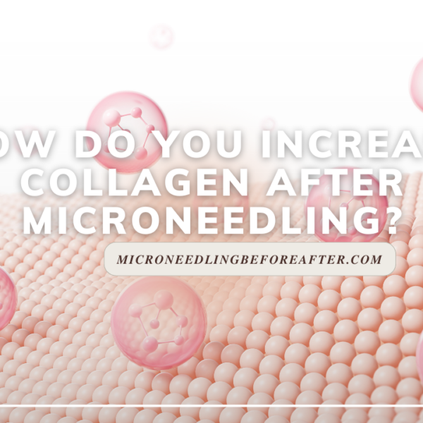 How Do You Increase Collagen After Microneedling?