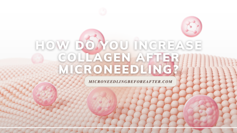 How Do You Increase Collagen After Microneedling?