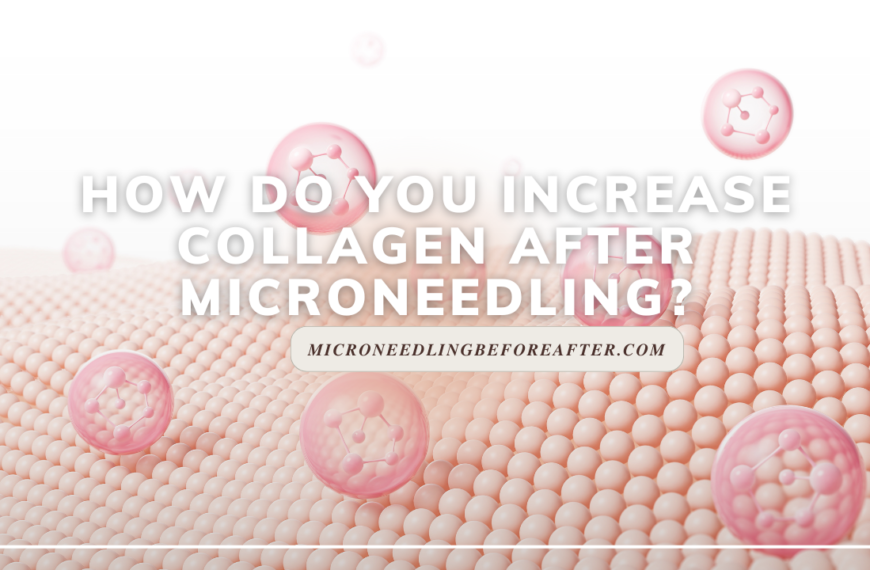 How Do You Increase Collagen After Microneedling?