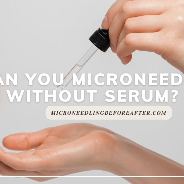Can You Microneedle Without Serum?