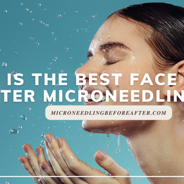 Best Face Wash After Microneedling