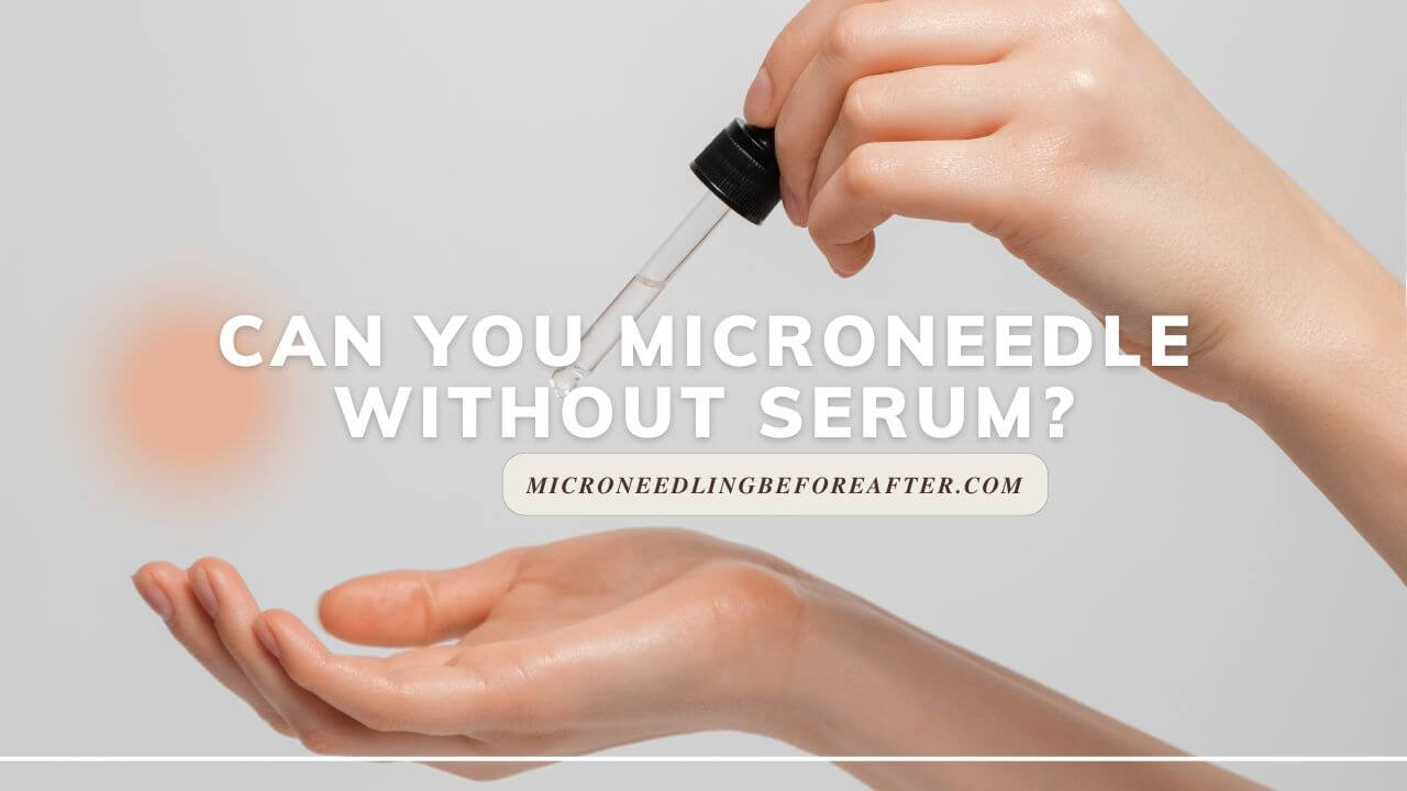 Can You Microneedle Without Serum?