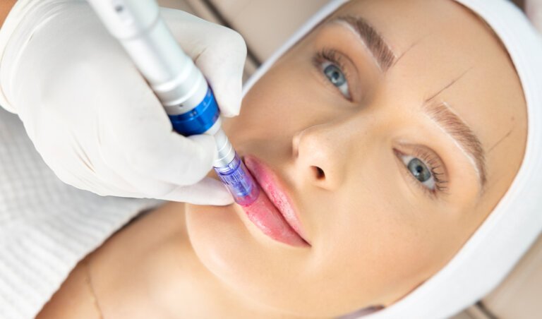 Is Microneedling On Lips Right For Me?