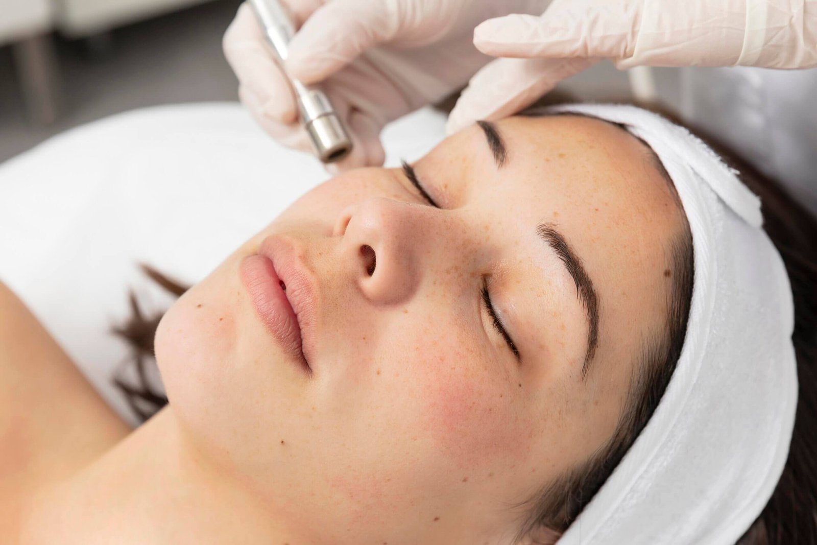 How Can I Speed Up The Healing Process After Microneedling?