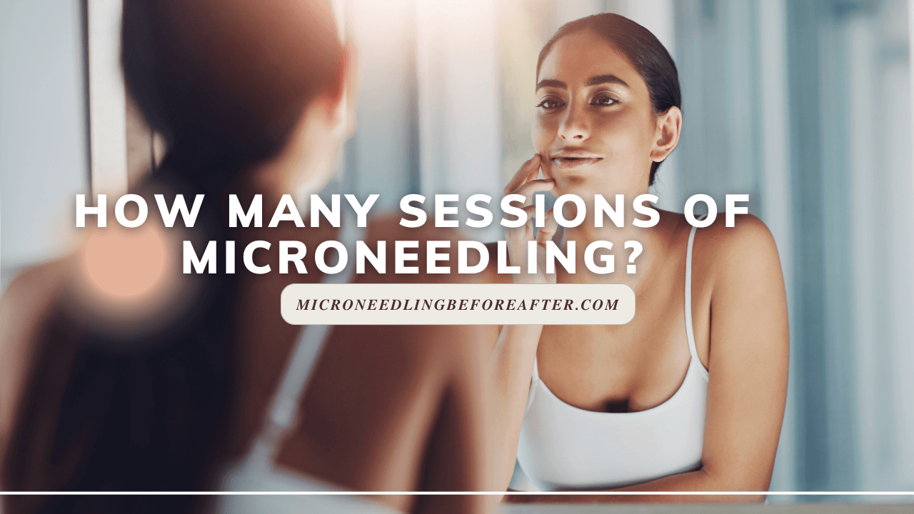 How Many Sessions Of Microneedling?