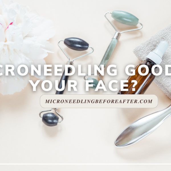 Is Microneedling Good For Your Face?