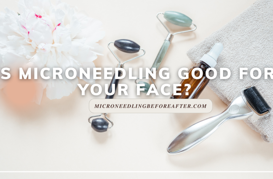 Is Microneedling Good For Your Face?