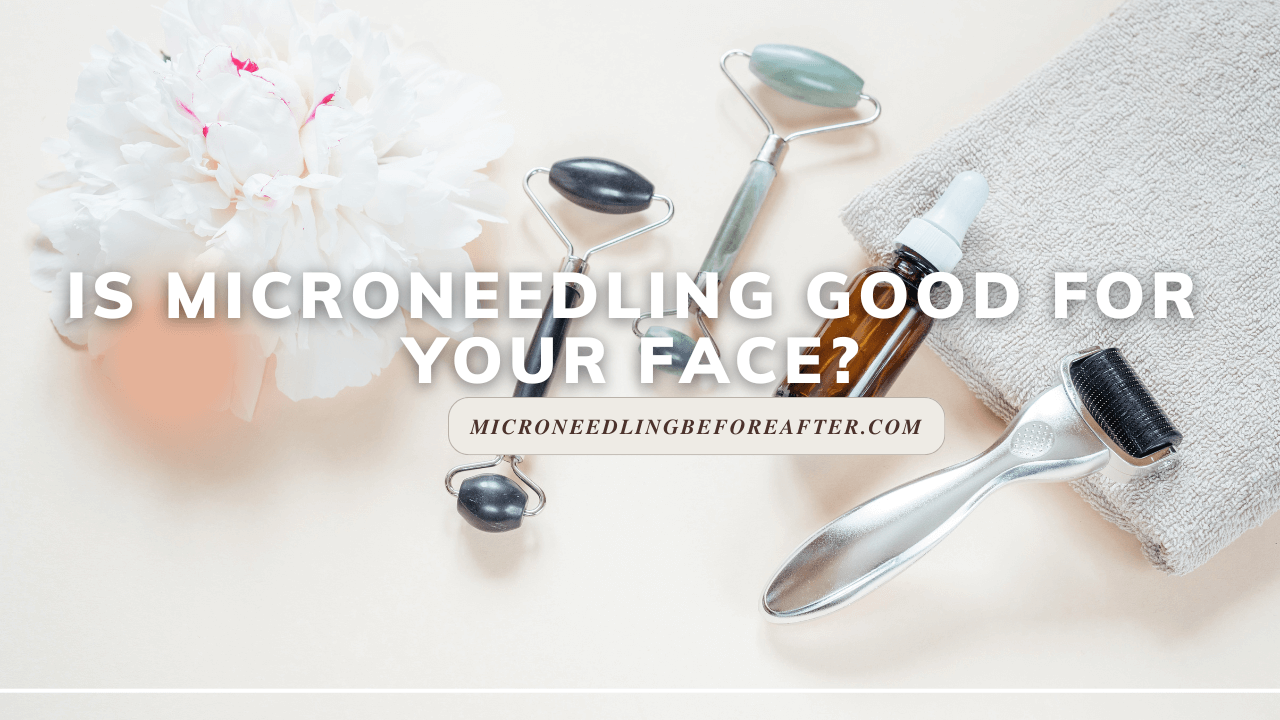 Is Microneedling Good For Your Face?