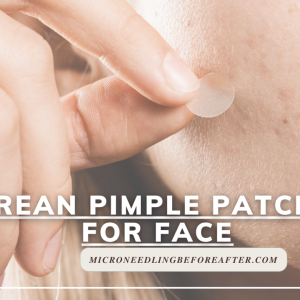 Korean Pimple Patches For Face