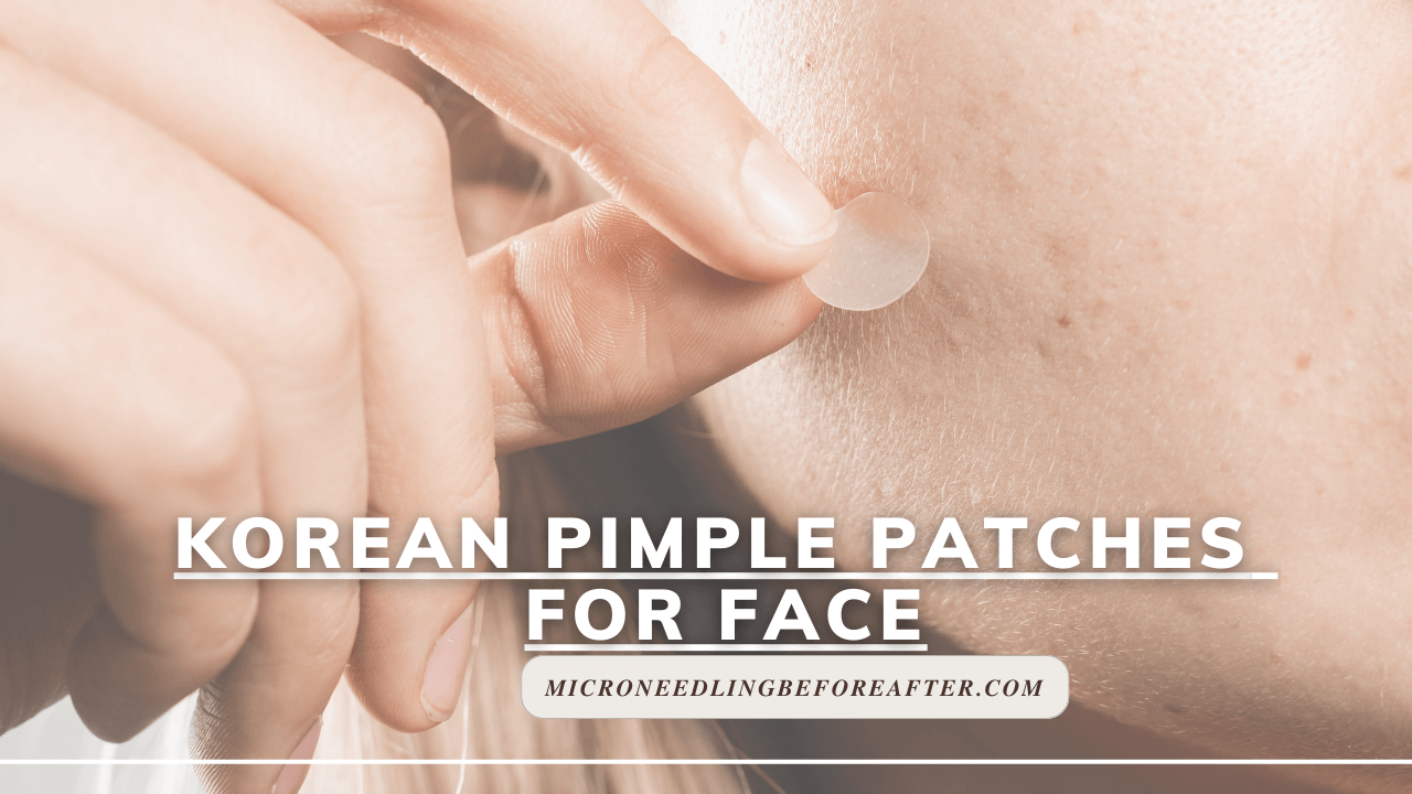 Korean Pimple Patches For Face