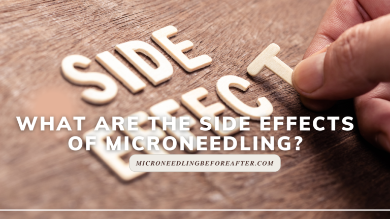 What Are The Side Effects Of Microneedling