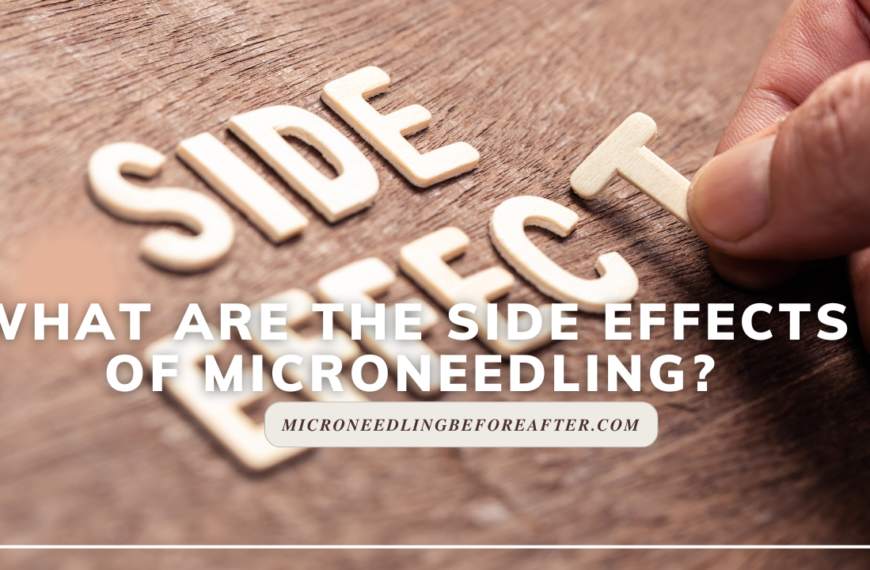 What Are The Side Effects Of Microneedling