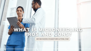 What Is Microneedling Pros And Cons?