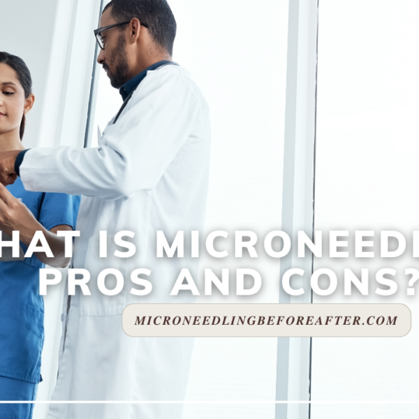 What Is Microneedling Pros And Cons?